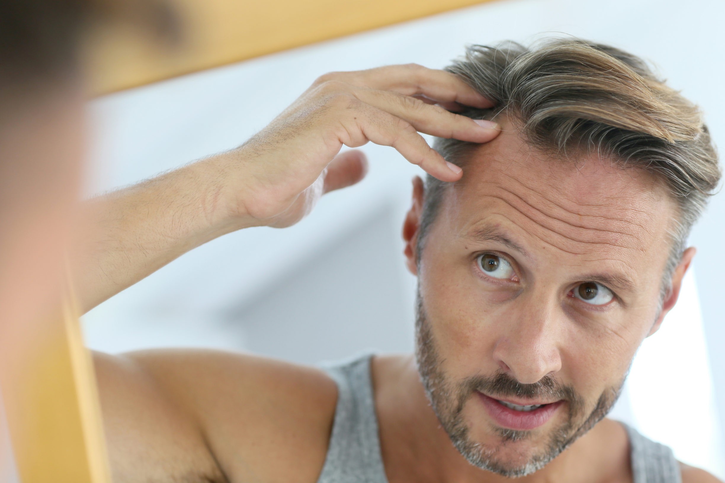 Men’s Hair Loss Treatment